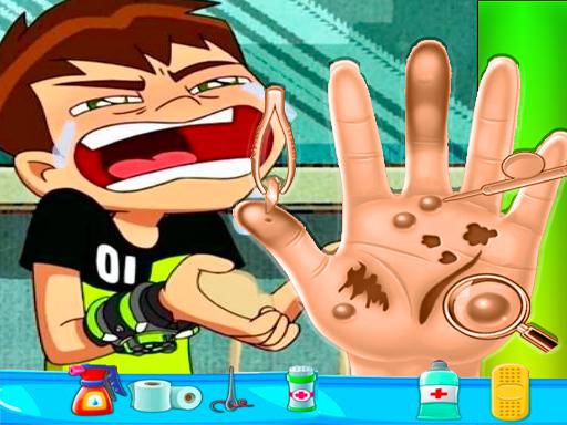 Ben10 Hand Doctor