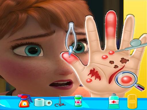 Anna Frozen Hand Doctor